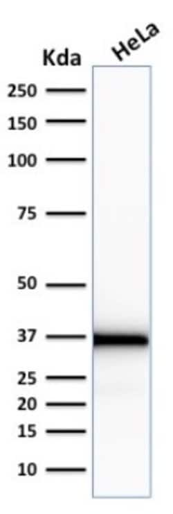 Emerin, Mouse anti-Human, Clone: EMD/2167, Novus Biologicals:Antibodies:Primary